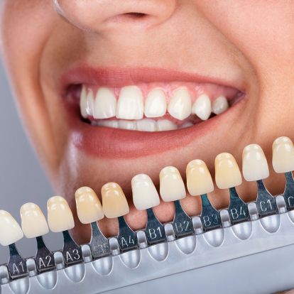 Ästhetische Zahnheilkunde der Zahnärzte in Garbsen und Vinnhorst